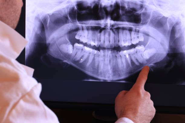 Best Weekend Emergency Dentist in Charlotte, TN